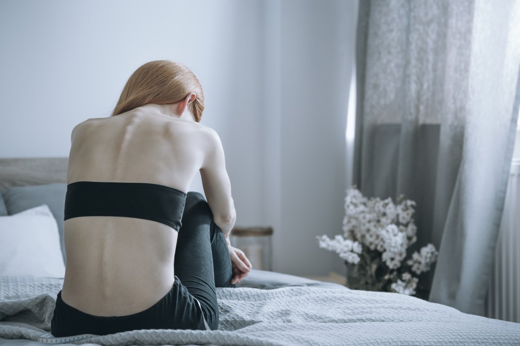 Woman with anorexia in bed