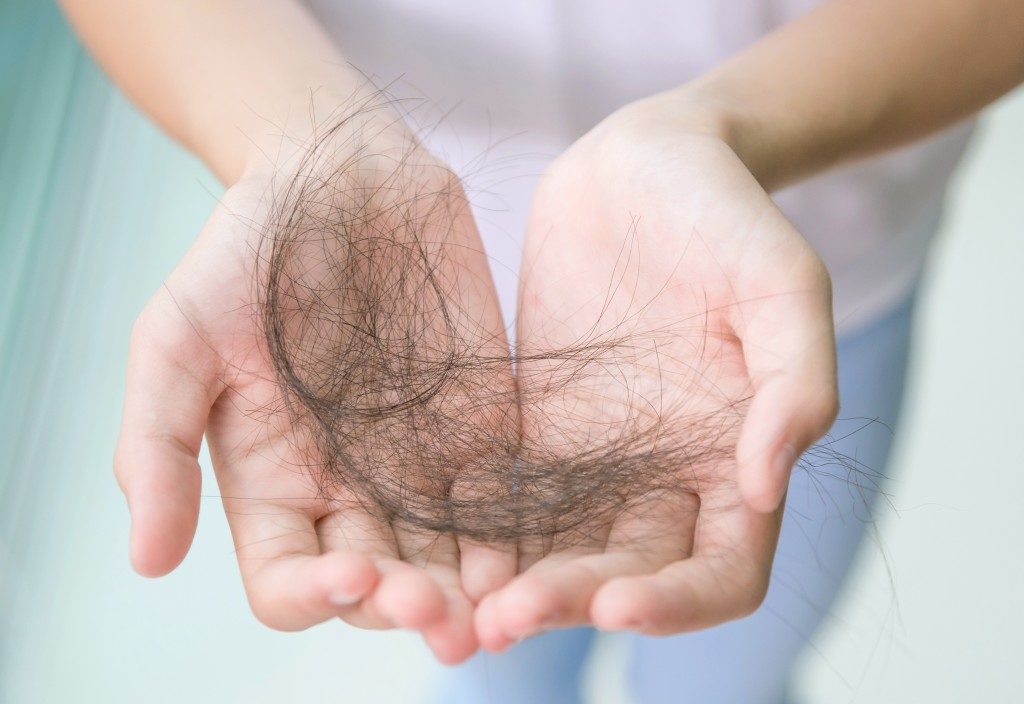 hairloss, fallen hair on hands